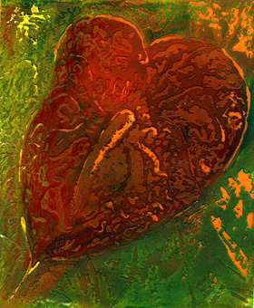 Anthurium series