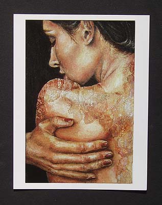 'Skin Deep' Postcard