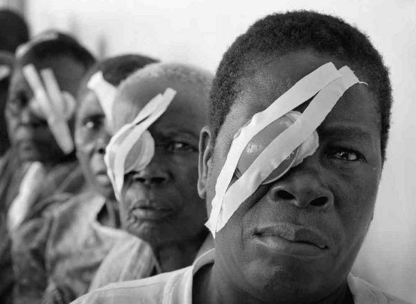Eye hospital Lilongwe ,Malawi